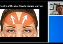 How To Reduce Scarring